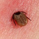 Living With Chronic Lyme Disease: Tips and Strategies for Coping